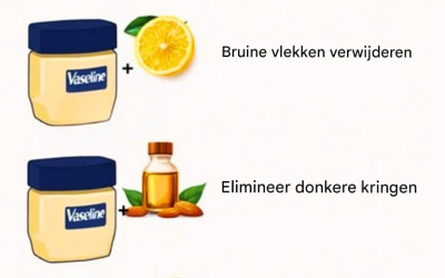 10 tips met vaseline