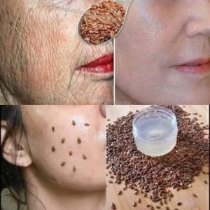 Zelfs als je 70 bent, gebruik het tegen rimpels – je gezicht wordt steviger als glas! Sterker dan Botox!