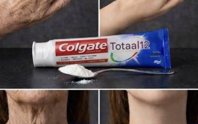 De thuisbehandeling die je huid transformeert. Het lijkt erop dat ik cosmetische chirurgie heb gehad! Om mijn recepten te blijven ontvangen, laat je een reactie achter… Bedankt!