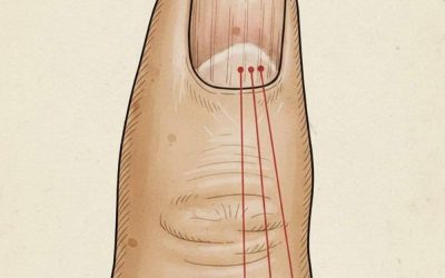 Merk je lijnen op je nagels? Hier is een zachte gids voor volwassenen die willen begrijpen wat hun nagels hen kunnen vertellen