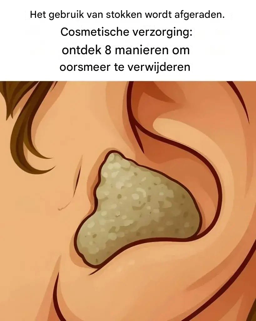 8 zachte en veilige oplossingen om afscheid te nemen van Earwax-accumulatie