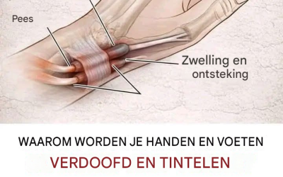 Waarom vallen je handen in slaap? Veel voorkomende oorzaken en natuurlijke remedies die daadwerkelijk werken